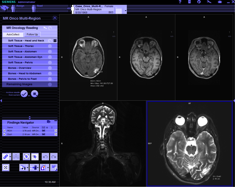 screenshot of the software showing an MRI of a person